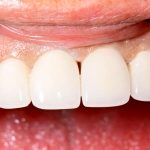 Understanding Oral Diseases: Insights from the Field of Oral Pathology