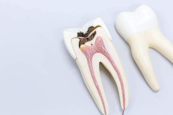The Significance of Dental Roots